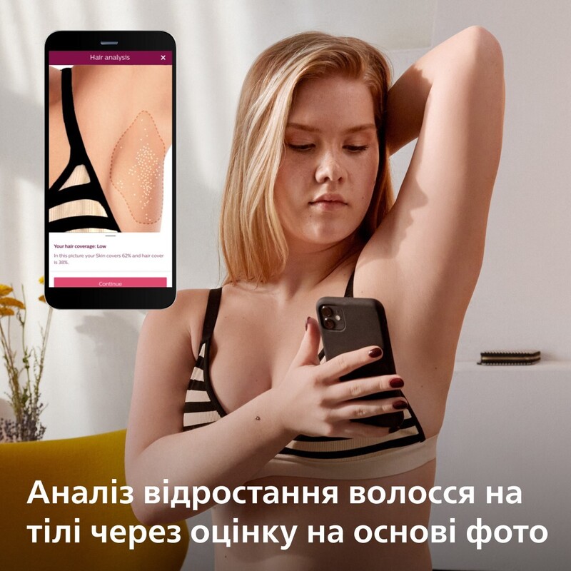 Фотоэпилятор PHILIPS Lumea серии 9900 BRI973/00 с технологией SenseIQ фото