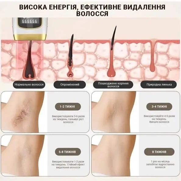 Фотоепілятор Inspire Sapphire XM-L011BK - фото - №3