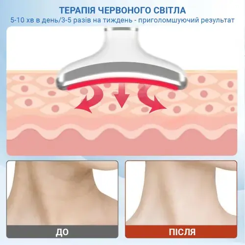 Мікрострумовий масажер для шиї та обличчя AIMED Neck RF Lifting EMS+LED Pink - фото - №4